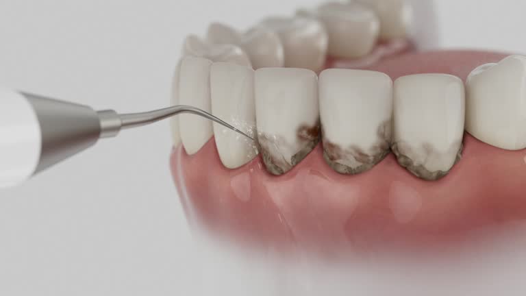 Reliable Dental contractor in Summit, MS by Smile Center Dentistry
